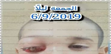 زياد حضر من قنا للعلاج ففقد عينه بالقاهرة