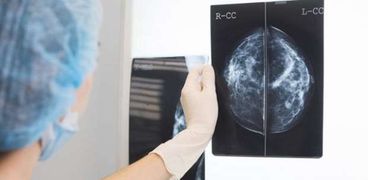 بعد تفوقها على الأطباء.. تقنية حديثة تساعد على تشخيص حالات سرطان الثدي