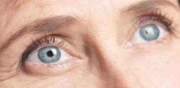 مرض الماء الأزرق في العين