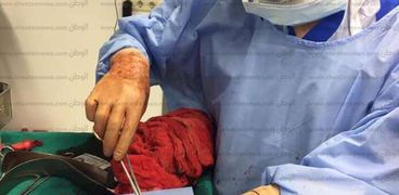 جراحة نادرة لسيدة بمستشفى كفر الشيخ الجامعي