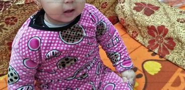 الطفلة خلود محمود التى تحتاج جراحات