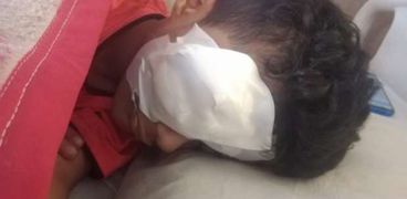الطفل أحمد بعد انفجار عينه بسبب صاروخ ألعاب نارية بالفيوم