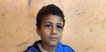 الطفل عبد الرحمن بعد  ان القاه عامل من فوق سطح مدرسة بسوهاج