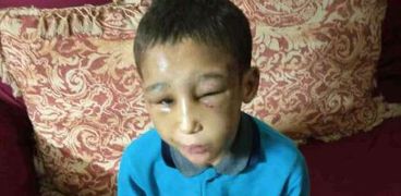 مصطفى طفل التعذيب