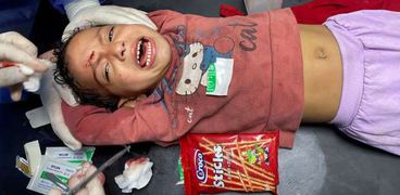 أطفال غزة المصابين ضحايا العدوان