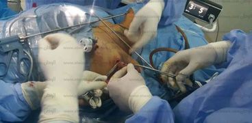 العملية الجراحية