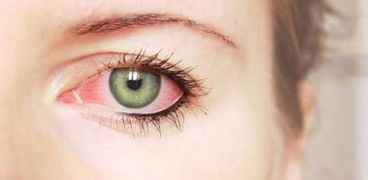 تأثير السكر علي العين