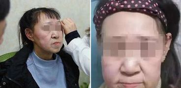 صورة للفتاة الصينية المصابة بالشيخوخة المبكرة