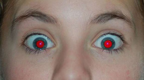 تكشف أمراضا خطيرة.. ماذا يعني ظهور العين الحمراء في الصور؟