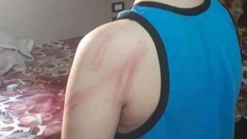 صورة مجازاة معلمة علوم في الفيوم أبرحت طالباً ضرباً بـ«خرطوم» – المحافظات