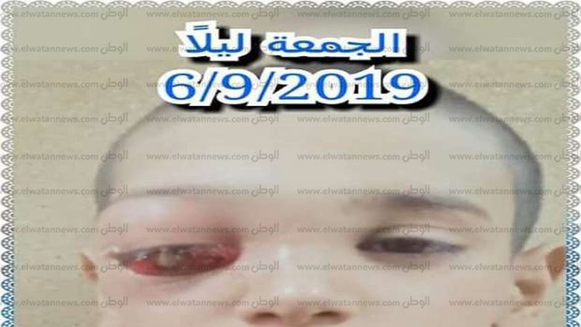 زياد حضر من قنا للعلاج ففقد عينه بالقاهرة