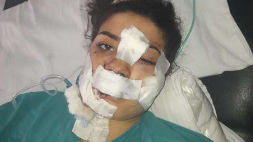 التفاصيل الكاملة لحادث إسراء عماد التي اعتدى عليها زوجها (صور وفيديو) -  المحافظات - الوطن